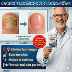 FungiPatch™ – Solución efectiva contra hongos en uñas.